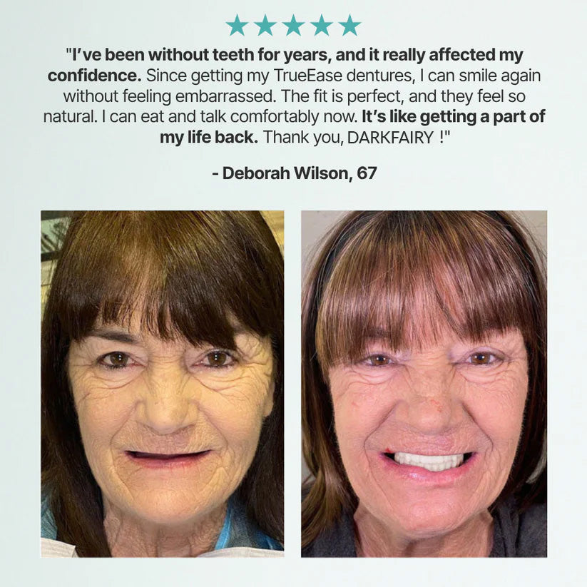 🌎🏆Ends Today: 78% OFF! 🏆2026 Bestselling Product🦷 Fit for a Fresh Smile, Say Goodbye to Wearing Discomfort!