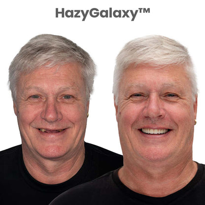 '--🦷 HazyGalaxy™ Custom-Fit Dentures ⏰ ENDS TODAY   75% OFF | Smile with Confidence